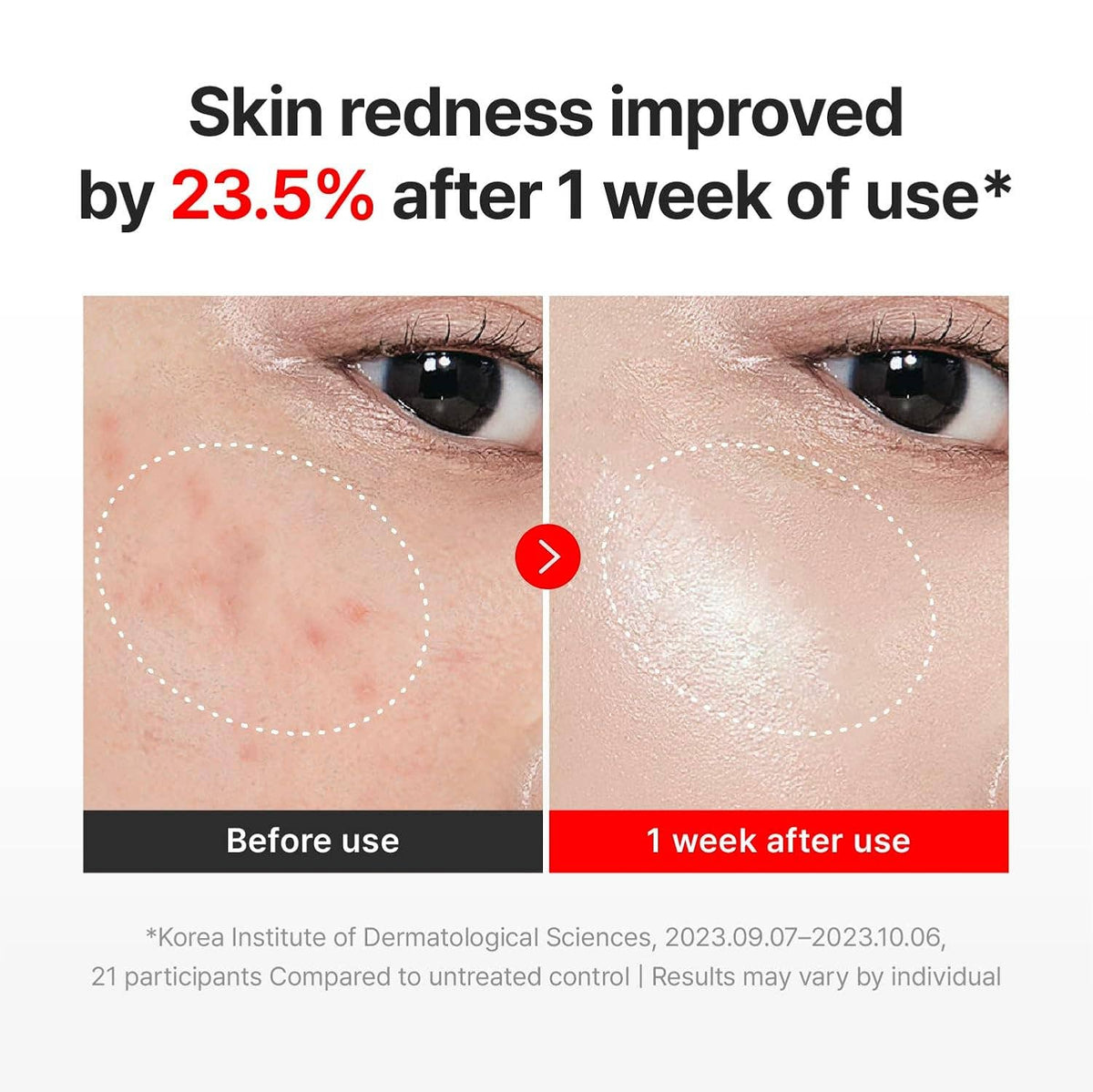 CENTELLIAN 24 Madeca Cream