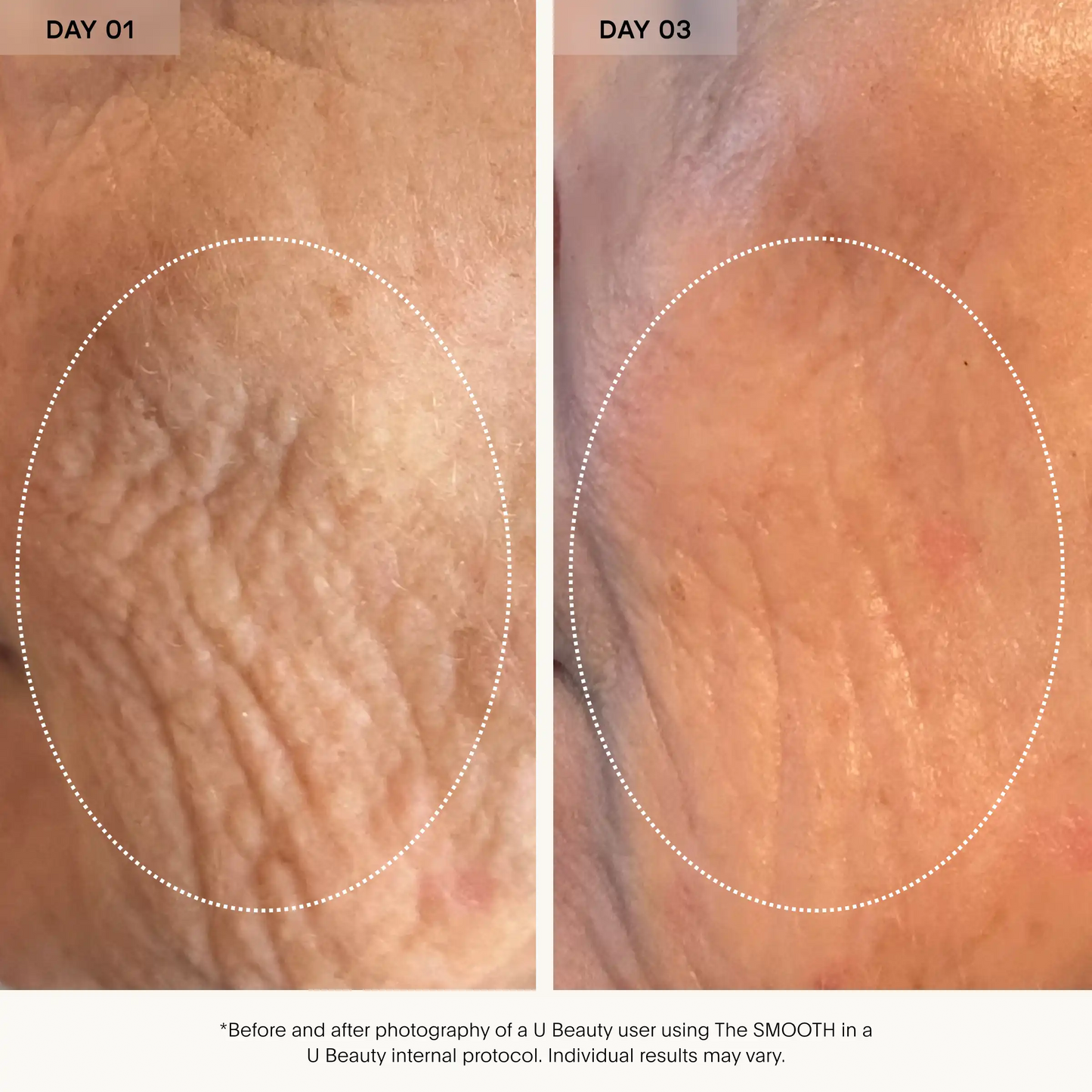 U BEAUTY The Smooth Dynamic Wrinkle Defense Serum